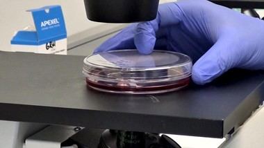 El Hospital 12 de Octubre valida una vacuna oral contra el virus del Ébola